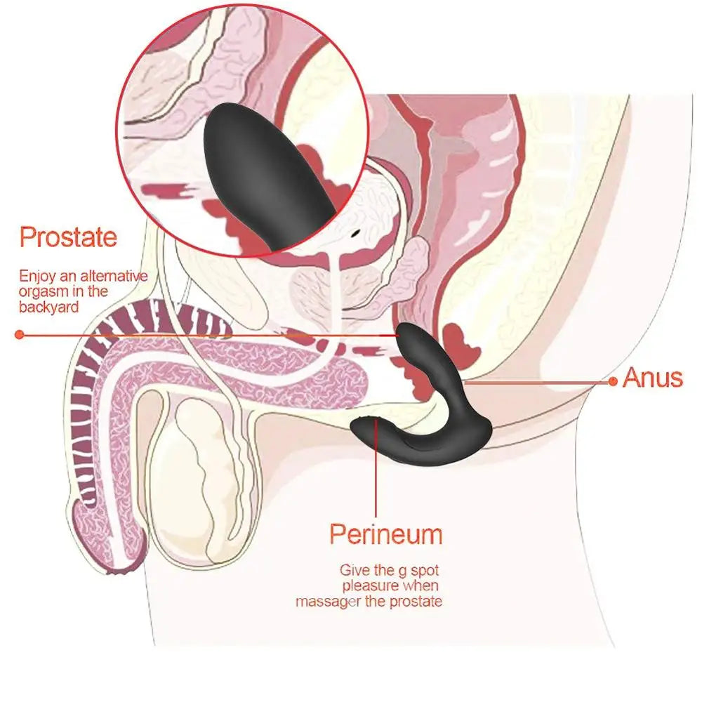 Plug anal vibrant avec télécommande sans